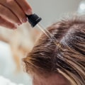 Understanding and Overcoming Hair Loss: The Benefits of Essential Oils