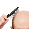 Understanding the Link Between Poor Diet and Hair Loss