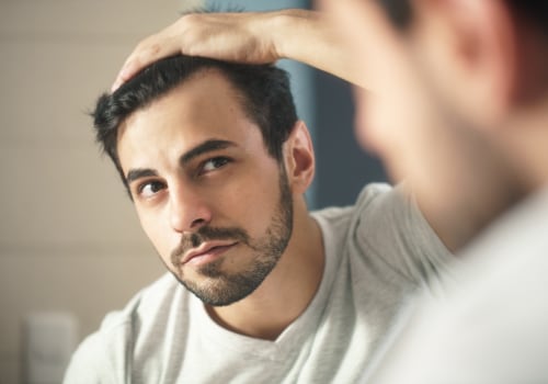 Hairstyles for Thinning Hair: Understanding and Overcoming Mental and Physical Challenges