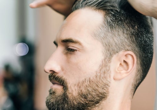 Hair Care Routine for Managing Male Pattern Baldness