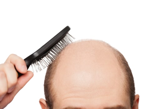 Understanding the Link Between Poor Diet and Hair Loss